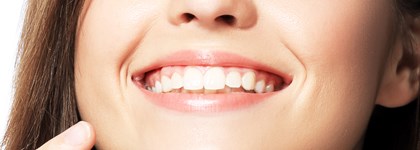 appareil Invisalign