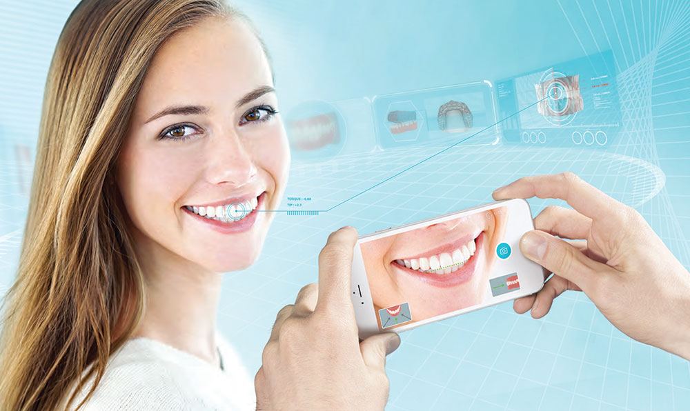 Patient gouttières invisibles Invisalign