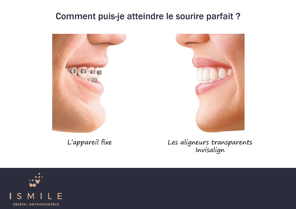 Comment puis-je atteindre le sourire parfait ?