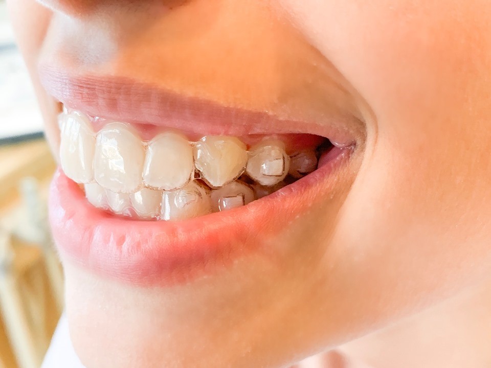 attachements en bouche